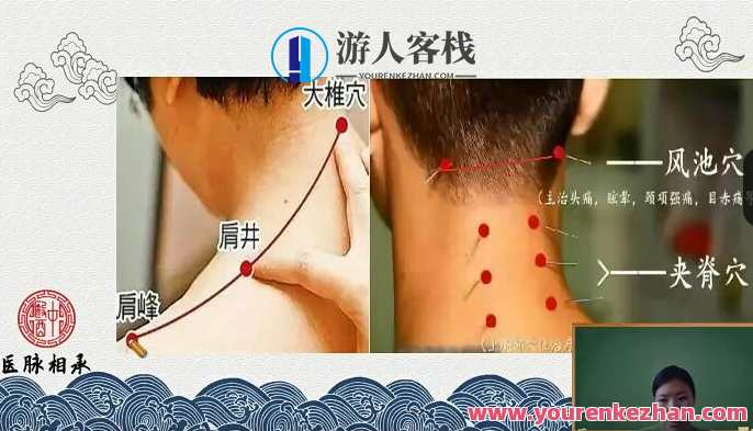 医脉相承王瑶十五组针灸特效方-中医特效针灸教学百度云盘分享，医脉传承，王瑶十五组针灸特效方教学分享