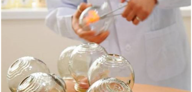 《拔罐法》视频教学,第1张