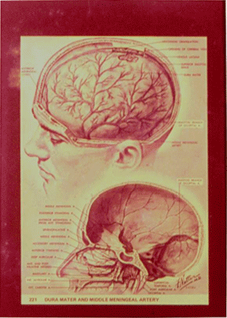 谢京城 颅内压增高