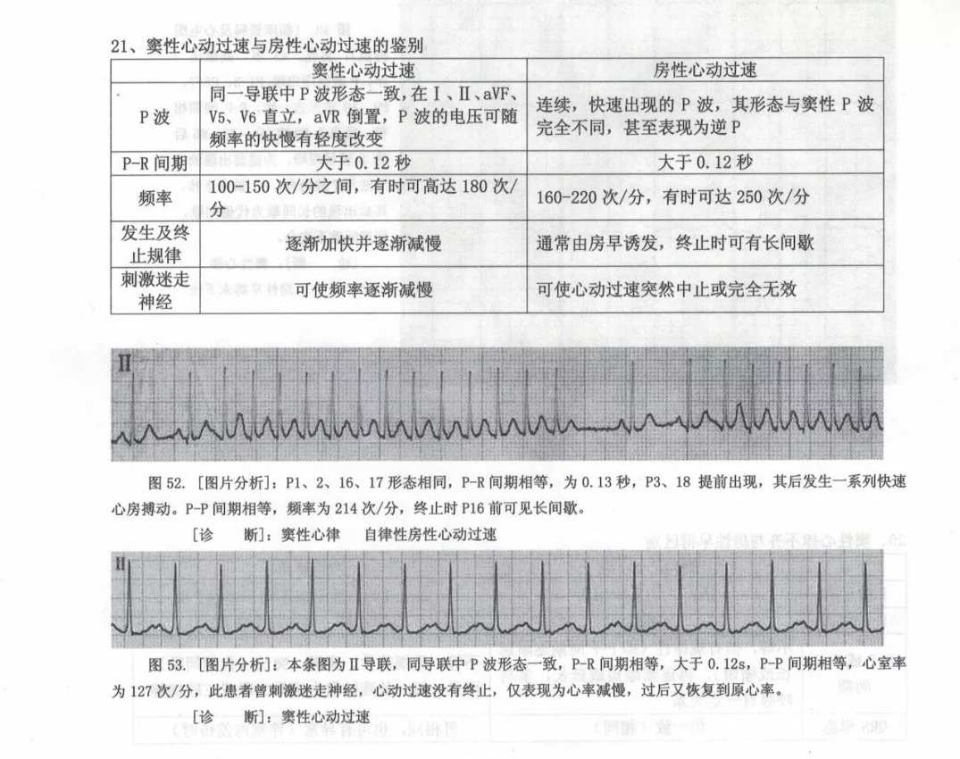 医学资源 心电图讲解视频,第1张