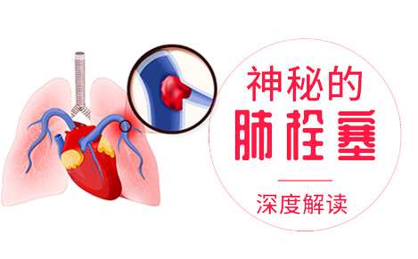 确诊肺栓塞 神秘的急性肺栓塞深度解读,课程,第1张 确诊肺栓塞 神秘的急性肺栓塞深度解读,课程,第1张