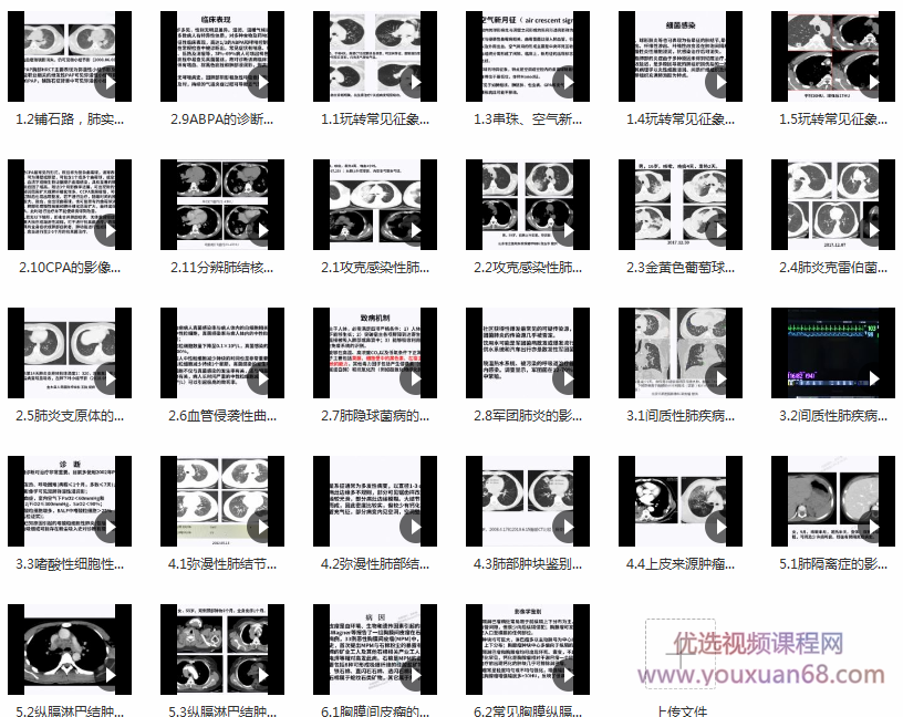 DXY诊断必备-肺部ct的诊断技巧及误区，教你成为肺部CT读片高手,课程,第2张