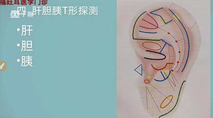 张福旺精讲耳穴诊断班,课程,第1张 张福旺精讲耳穴诊断班,课程,第1张