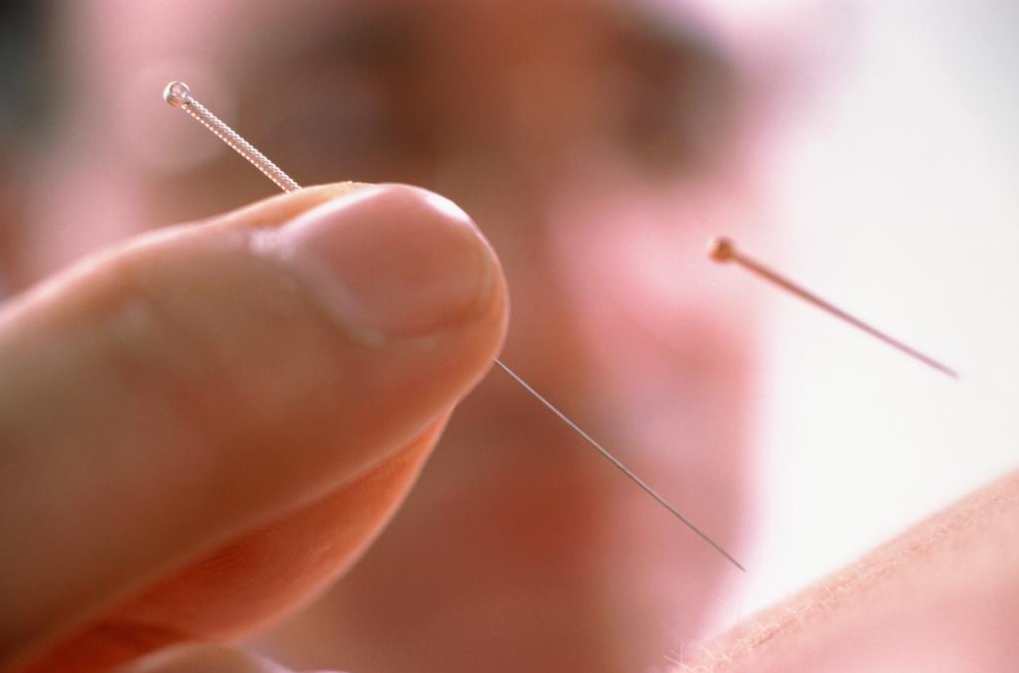 《针炙方法及常用穴位取穴法》增加《经外奇穴的部位和临床应用》,第1张