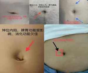 齐永老师初级脐针中医讲解,学习,中医,第1张