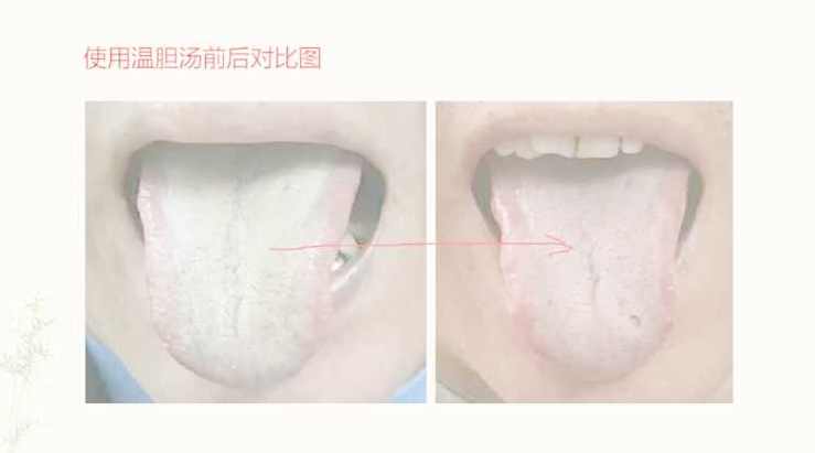 王瑞宽沈氏女科舌诊基础入门诊疗要点案例视频17讲,课程,学习,理解,定位,平衡,第2张