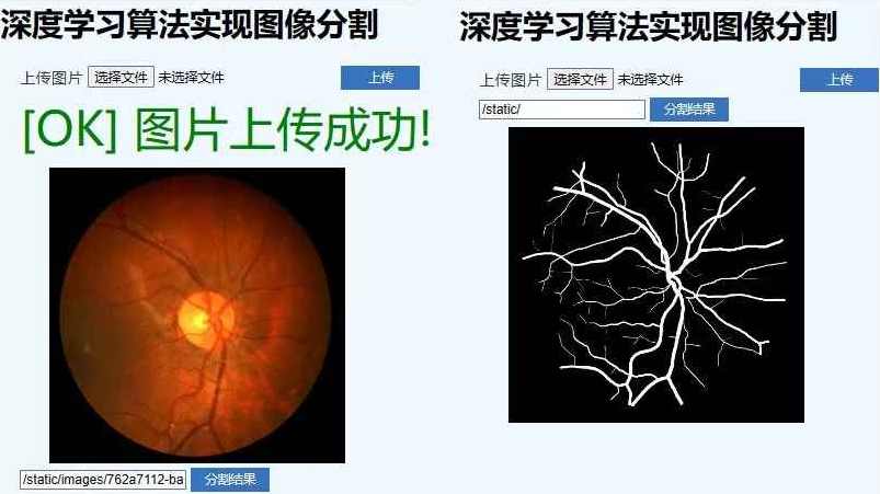 医学影像与图像分割:深度学习项目课,课程,学习,机器学习,第1张 医学影像与图像分割:深度学习项目课,课程,学习,机器学习,第1张